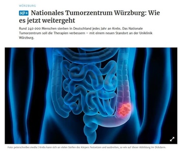 2021-12-07-Wuerzburg-Nationales-Tumorzentrum-Wuerzburg-Wie-Es-Jetzt-Weitergeht